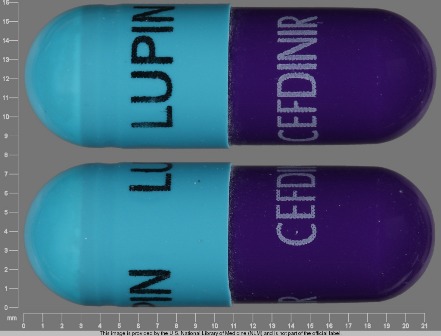 LUPIN CEFDINIR: (68180-711) Cefdinir 300 mg Oral Capsule by Nucare Pharmaceuticals, Inc.
